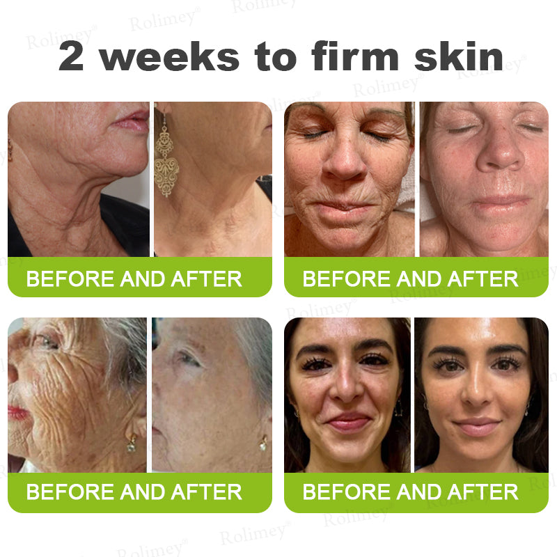 ✅ Rolimey® Vita-A Retinol Shot Wrinkle (upsell)