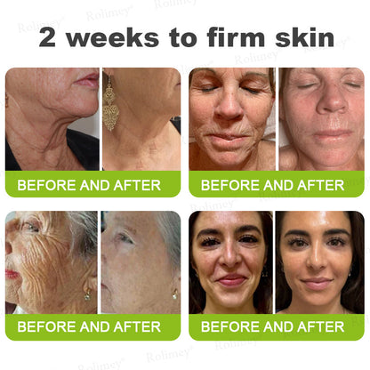 ✅ Rolimey® Vita-A Retinol Shot Wrinkle (upsell)