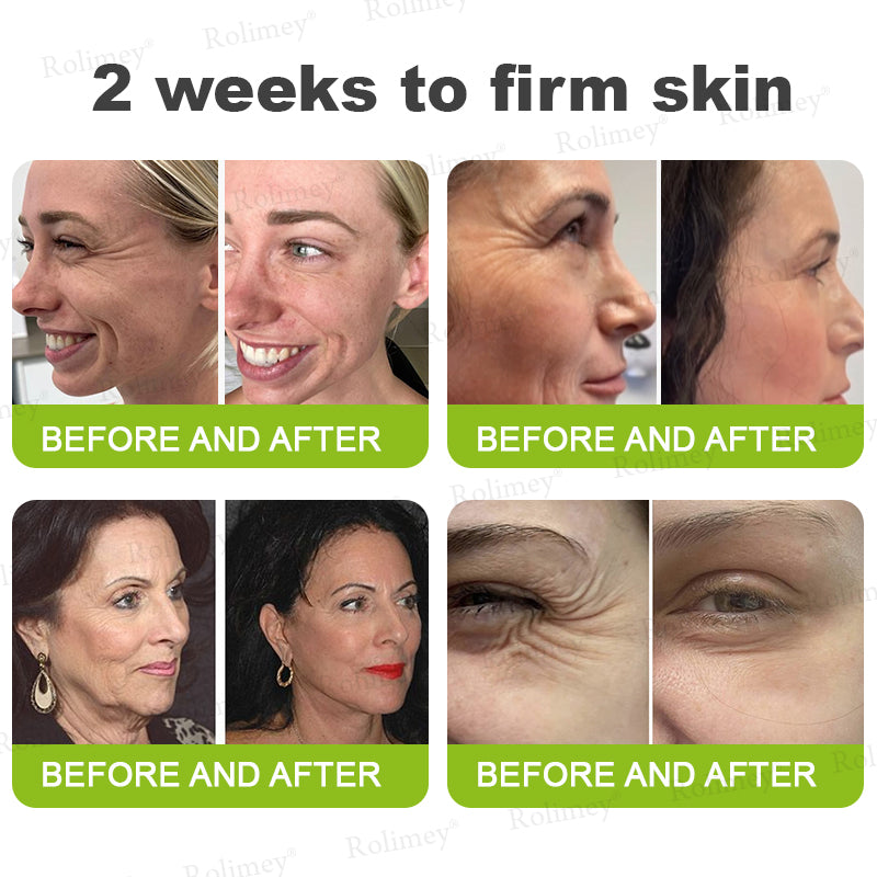 ✅ Rolimey® Vita-A Retinol Shot Wrinkle (upsell)