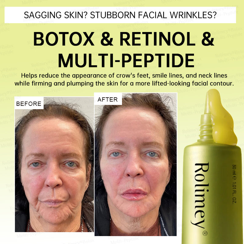 🏅🌿🎊Rolimey® Multi-Peptide Retinol Shot Wrinkle-Lift Cream