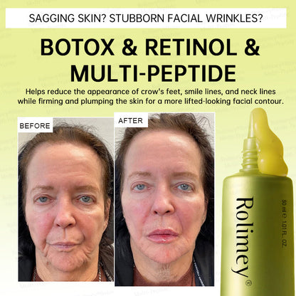 🏅🌿🎊Rolimey® Multi-Peptide Retinol Shot Wrinkle-Lift Cream