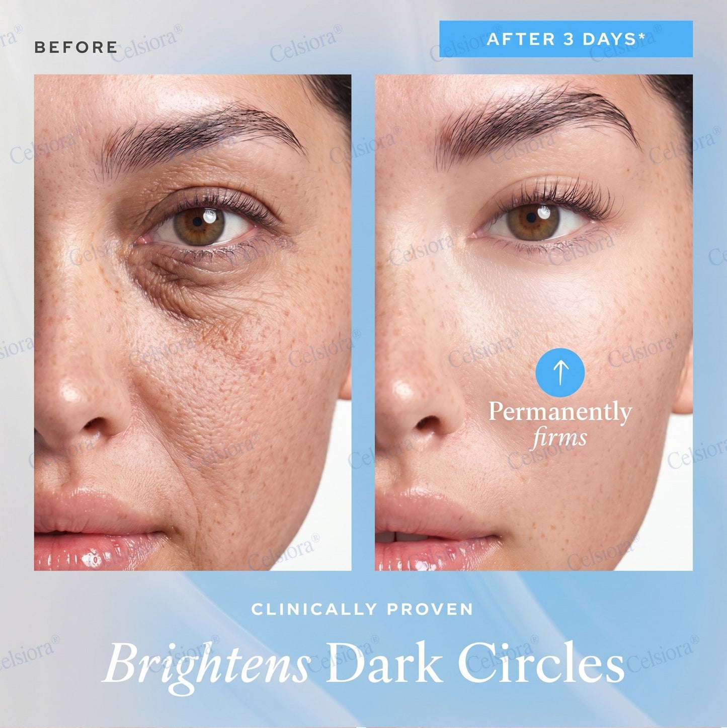 🌐🍃Celsiora® Botox & PDRN Anti-Wrinkle Shot – Lift & Firming Cream