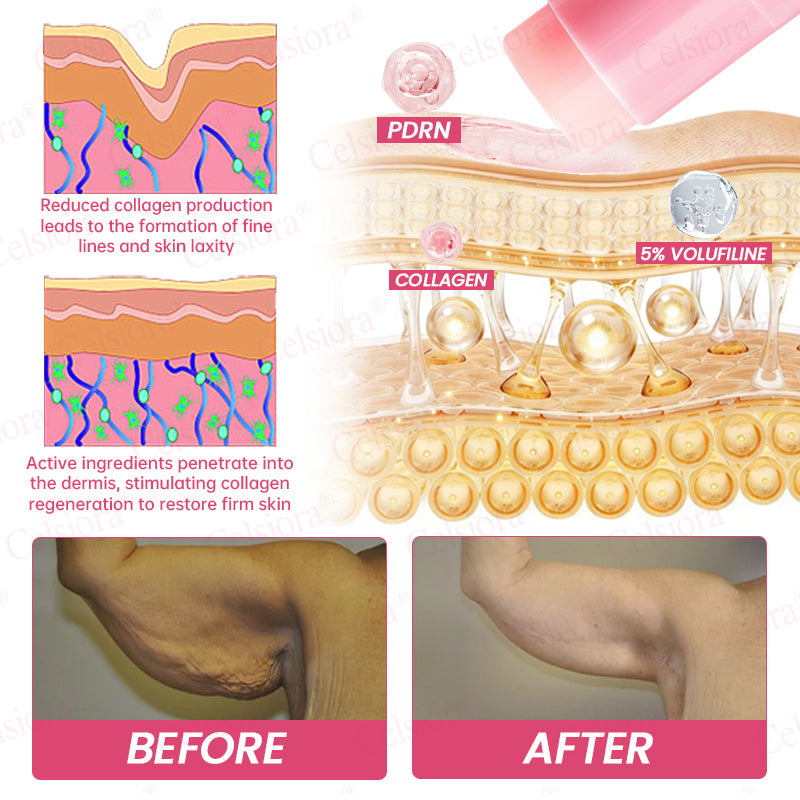 👩‍⚕️💙 💫Celsiora® PDRN + Collagen Wrinkle-Lift Tightening Serum Stick