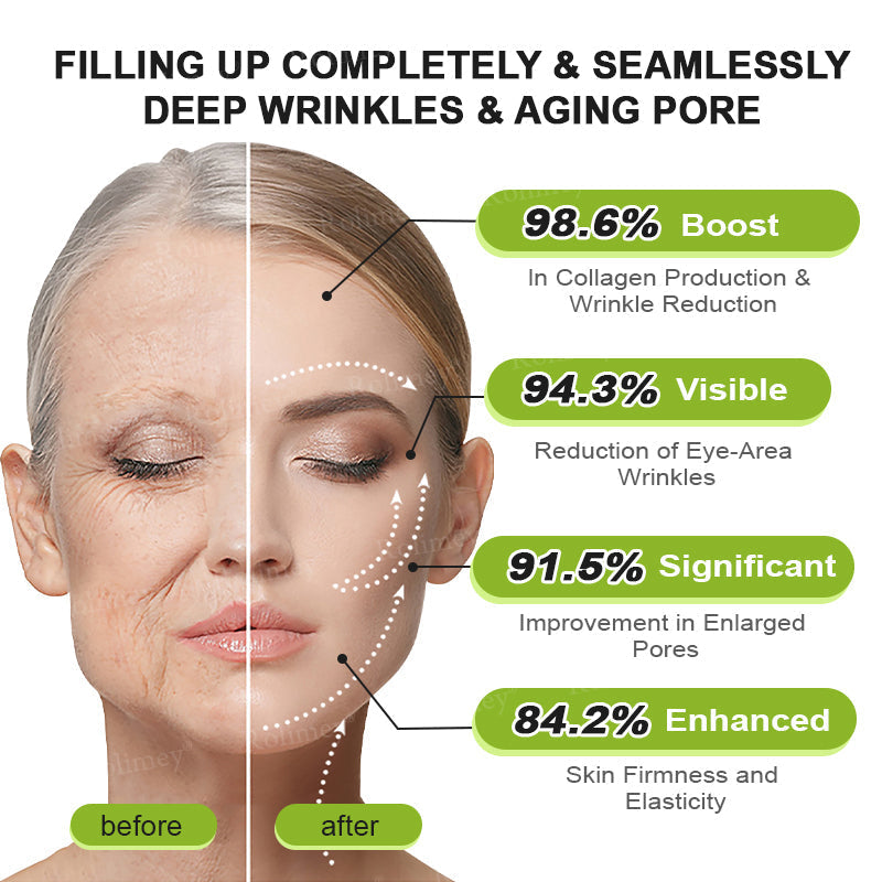 ✅ Rolimey® Vita-A Retinol Shot Wrinkle (upsell)