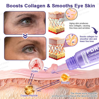 💄✨Celsiora® PDRN Renewal Complex Eye Cream | Wrinkles, Puffiness & Dark Circles