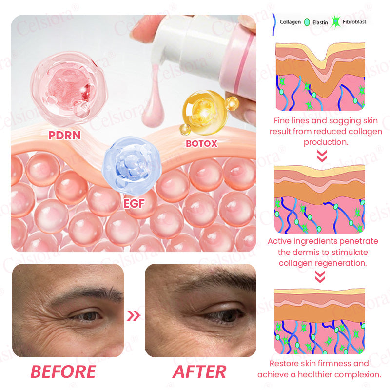 🩷💫Celsiora® PDRN Pink Peptide Eye Cream