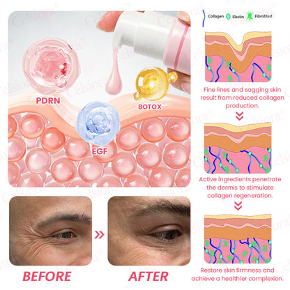 🩷💫Celsiora® PDRN Pink Peptide Eye Cream
