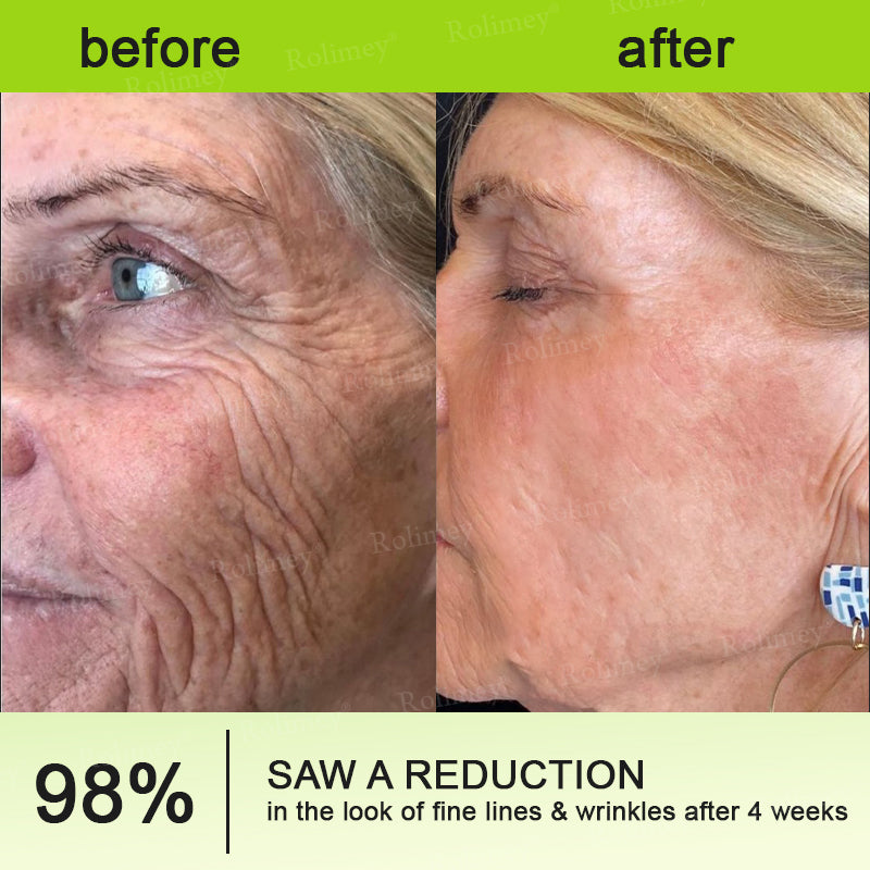 🐾💖🎊💫Rolimey®Wrinkle-Lift Tightening cream