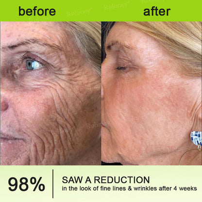 🐾💖🎊💫Rolimey®Wrinkle-Lift Tightening cream