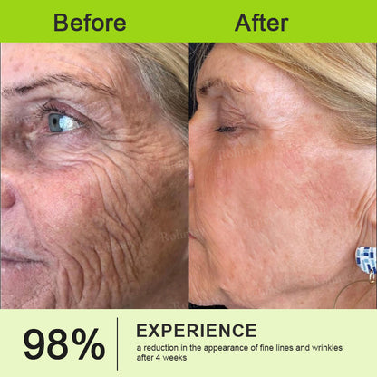 ✅ Rolimey® Vita-A Retinol Shot Wrinkle (upsell)