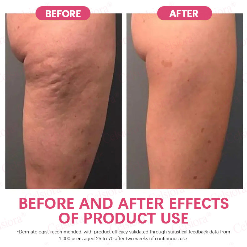👩‍⚕️💙 💫Celsiora® PDRN + Collagen Wrinkle-Lift Tightening Serum Stick