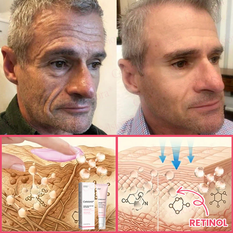 🩷💫Celsiora® PDRN Pink Peptide Eye Cream