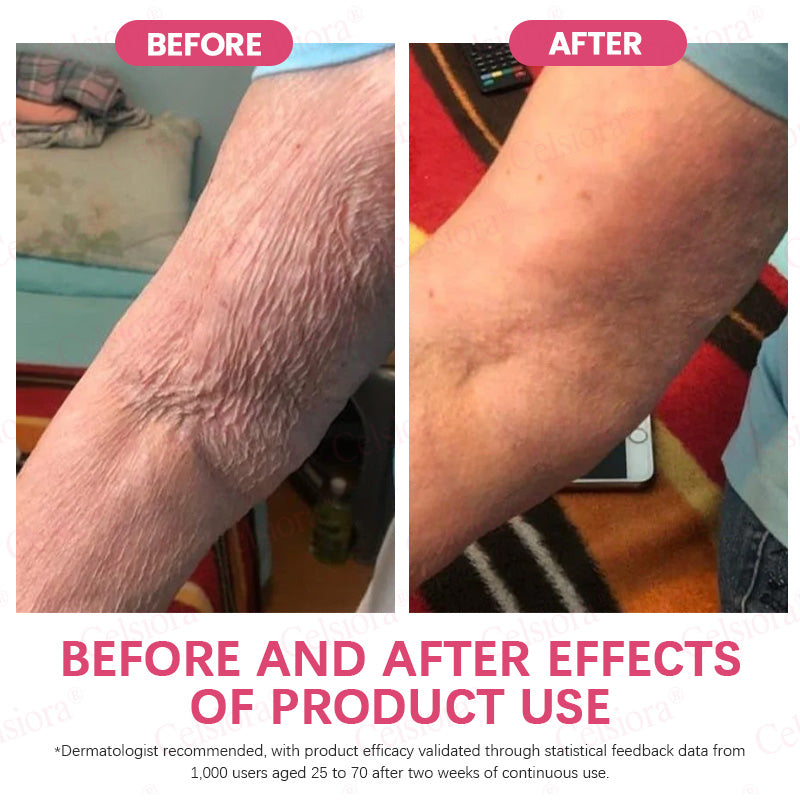👩‍⚕️💙 💫Celsiora® PDRN + Collagen Wrinkle-Lift Tightening Serum Stick