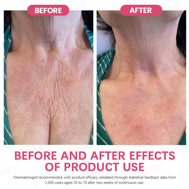 👩‍⚕️💙 💫Celsiora® PDRN + Collagen Wrinkle-Lift Tightening Serum Stick
