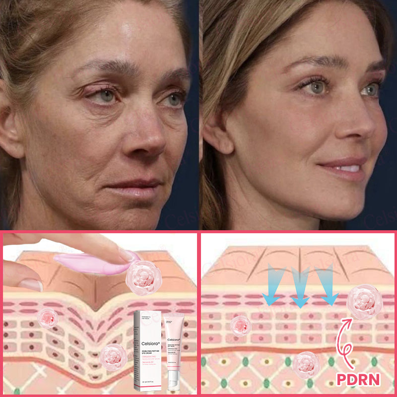 🩷💫Celsiora® PDRN Pink Peptide Eye Cream