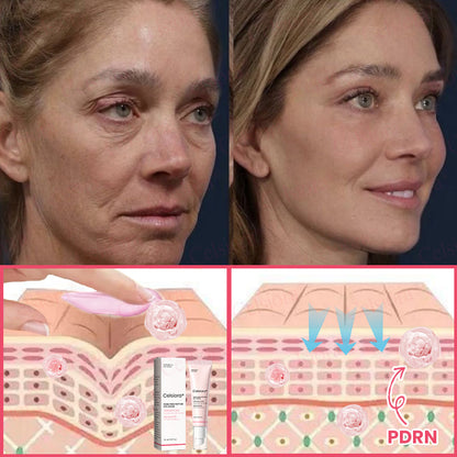 🩷💫Celsiora® PDRN Pink Peptide Eye Cream