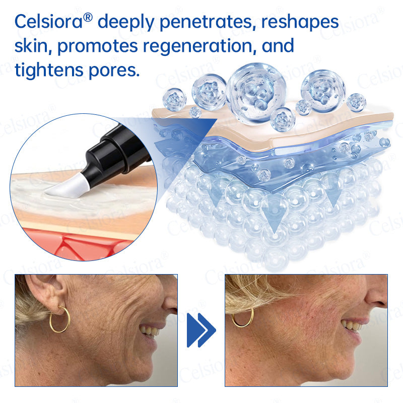 🌐🍃Celsiora® Botox & PDRN Anti-Wrinkle Shot – Lift & Firming Cream