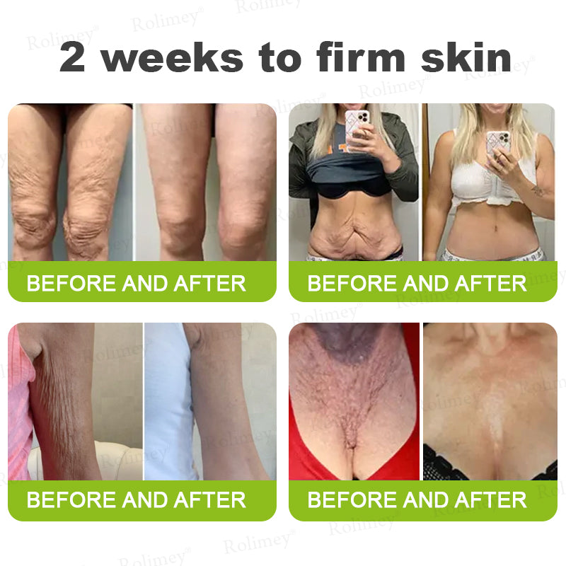 ✅ Rolimey® Vita-A Retinol Shot Wrinkle (upsell)