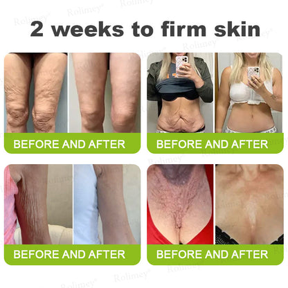 ✅ Rolimey® Vita-A Retinol Shot Wrinkle (upsell)