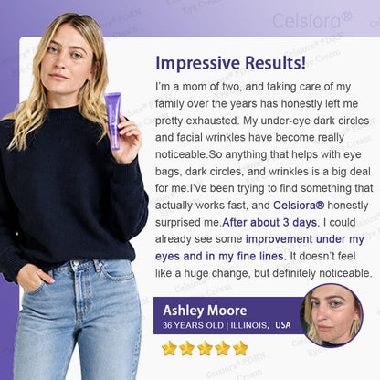 💄✨Celsiora® PDRN Renewal Complex Eye Cream | Wrinkles, Puffiness & Dark Circles