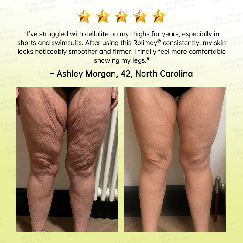 🏅🌿🎊Rolimey® Multi-Peptide Retinol Shot Wrinkle-Lift Cream