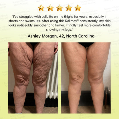 🏅🌿🎊Rolimey® Multi-Peptide Retinol Shot Wrinkle-Lift Cream
