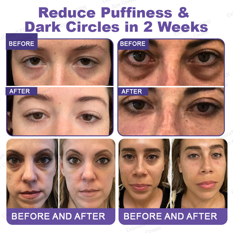💄✨Celsiora® PDRN Renewal Complex Eye Cream | Wrinkles, Puffiness & Dark Circles