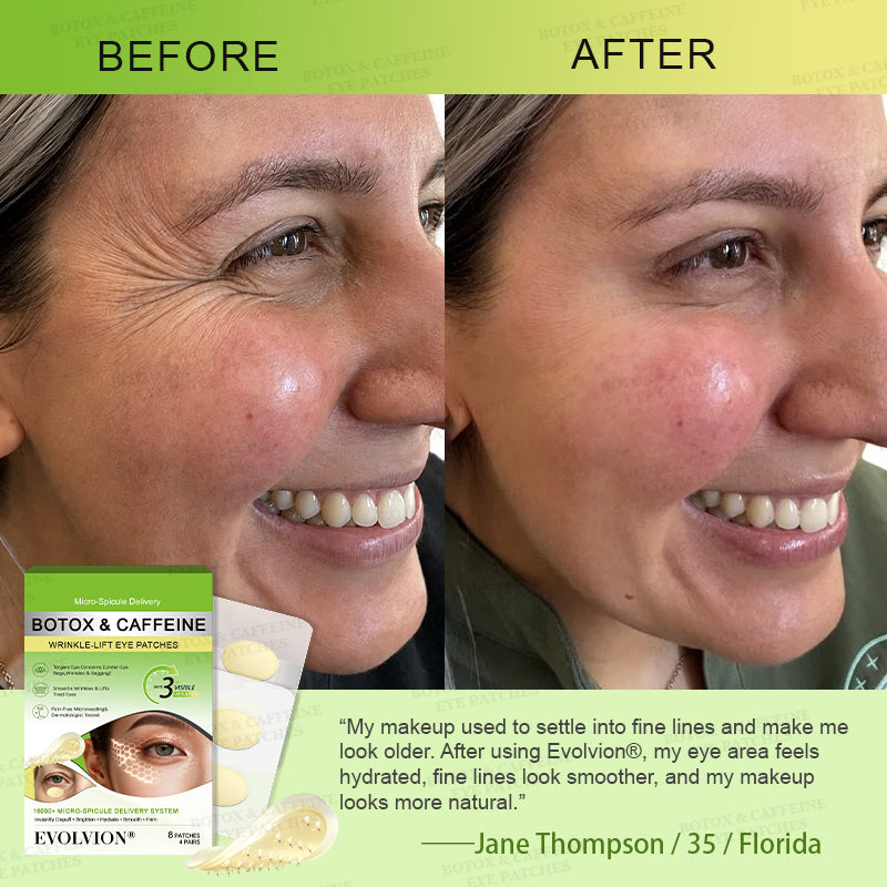 💗USA HOT SALES ✨Evolvion® Botox & Caffeine Wrinkle-Lift Eye Patches