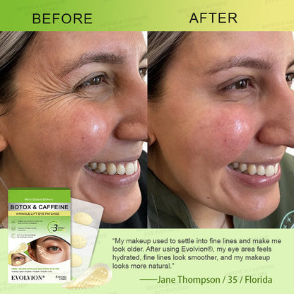 💗USA HOT SALES ✨Evolvion® Botox & Caffeine Wrinkle-Lift Eye Patches