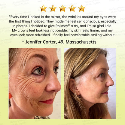 🏅🌿🎊Rolimey® Multi-Peptide Retinol Shot Wrinkle-Lift Cream