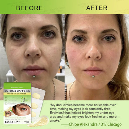 💗USA HOT SALES ✨Evolvion® Botox & Caffeine Wrinkle-Lift Eye Patches