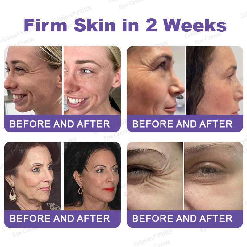 💄✨Celsiora® PDRN Renewal Complex Eye Cream | Wrinkles, Puffiness & Dark Circles