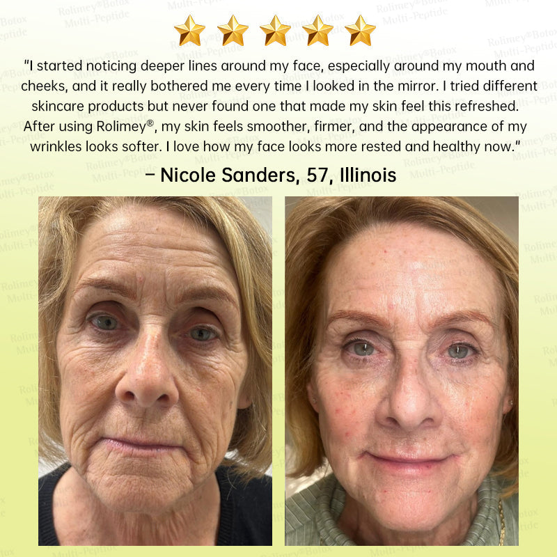 🏅🌿🎊Rolimey® Multi-Peptide Retinol Shot Wrinkle-Lift Cream