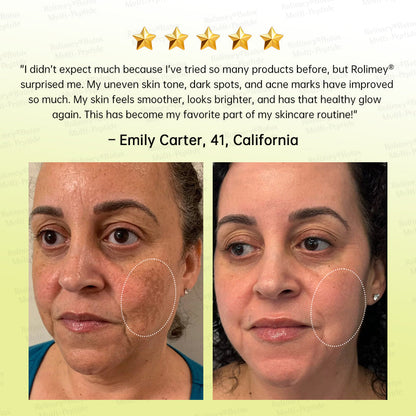 🏅🌿🎊Rolimey® Multi-Peptide Retinol Shot Wrinkle-Lift Cream