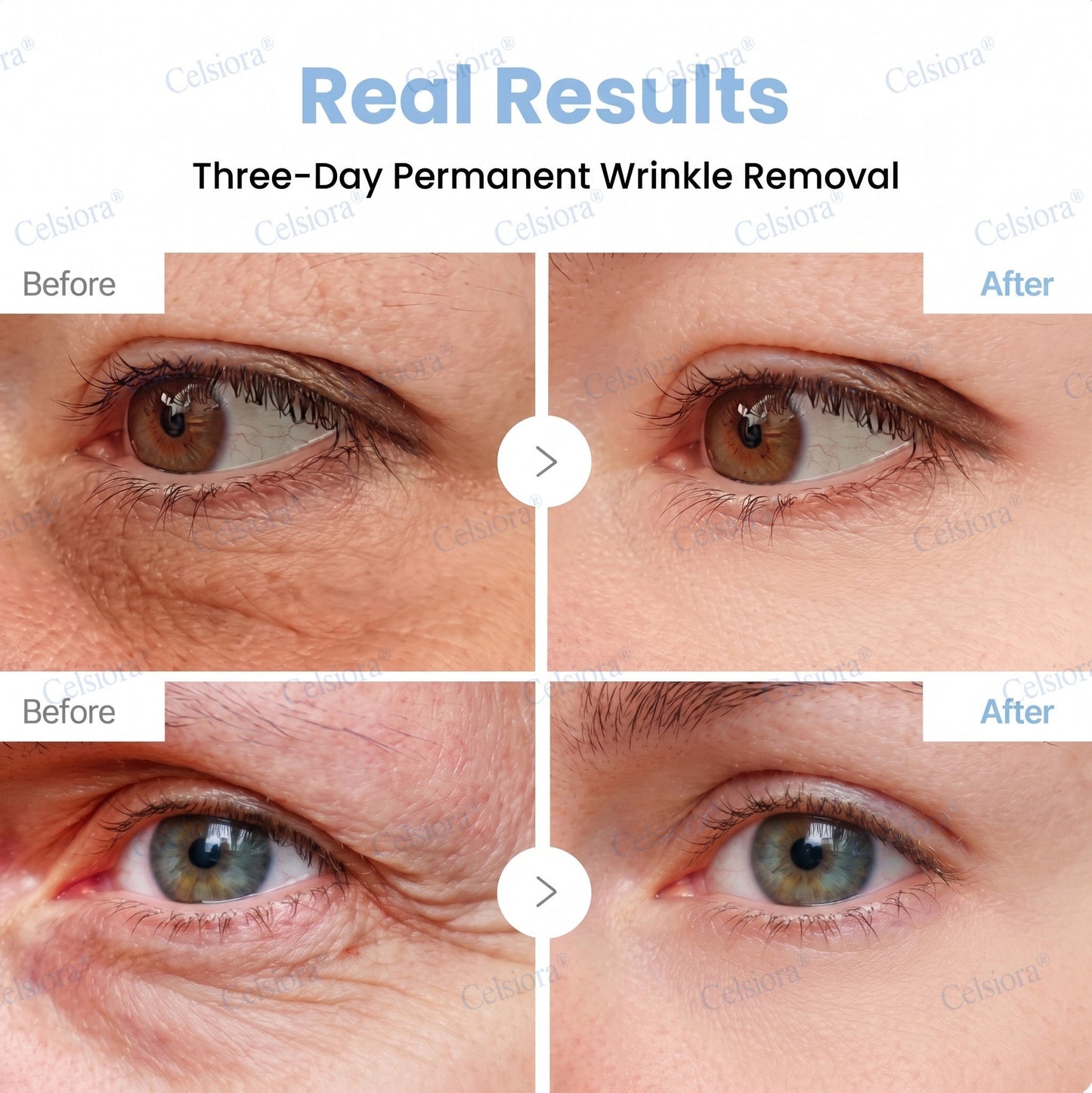 🌐🍃Celsiora® Botox & PDRN Anti-Wrinkle Shot – Lift & Firming Cream