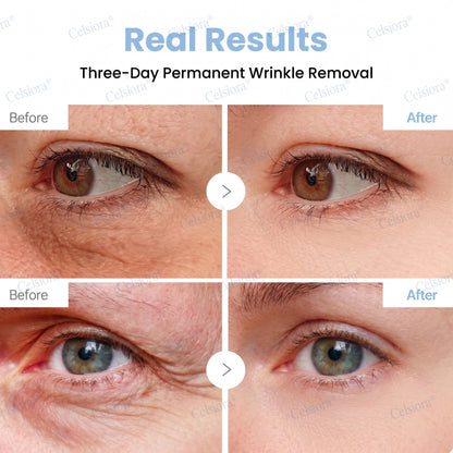 🌐🍃Celsiora® Botox & PDRN Anti-Wrinkle Shot – Lift & Firming Cream