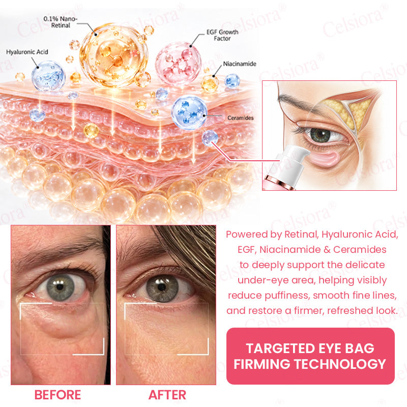🩷Celsiora® PDRN Pink Peptide Renewal Cream 👩‍⚕️Firm, Smooth & Revitalize Aging Skin