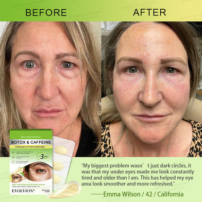 💗USA HOT SALES ✨Evolvion® Botox & Caffeine Wrinkle-Lift Eye Patches