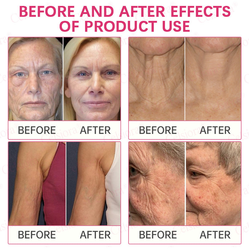 👩‍⚕️💙 💫Celsiora® PDRN + Collagen Wrinkle-Lift Tightening Serum Stick