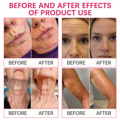 👩‍⚕️💙 💫Celsiora® PDRN + Collagen Wrinkle-Lift Tightening Serum Stick