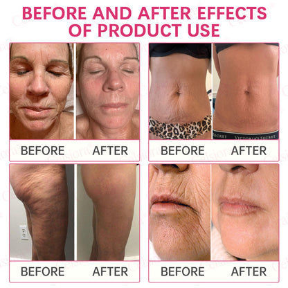 👩‍⚕️💙 💫Celsiora® PDRN + Collagen Wrinkle-Lift Tightening Serum Stick
