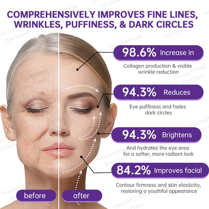💄✨Celsiora® PDRN Renewal Complex Eye Cream | Wrinkles, Puffiness & Dark Circles