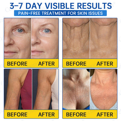 🌐🍃Celsiora® Botox & PDRN Anti-Wrinkle Shot – Lift & Firming Cream