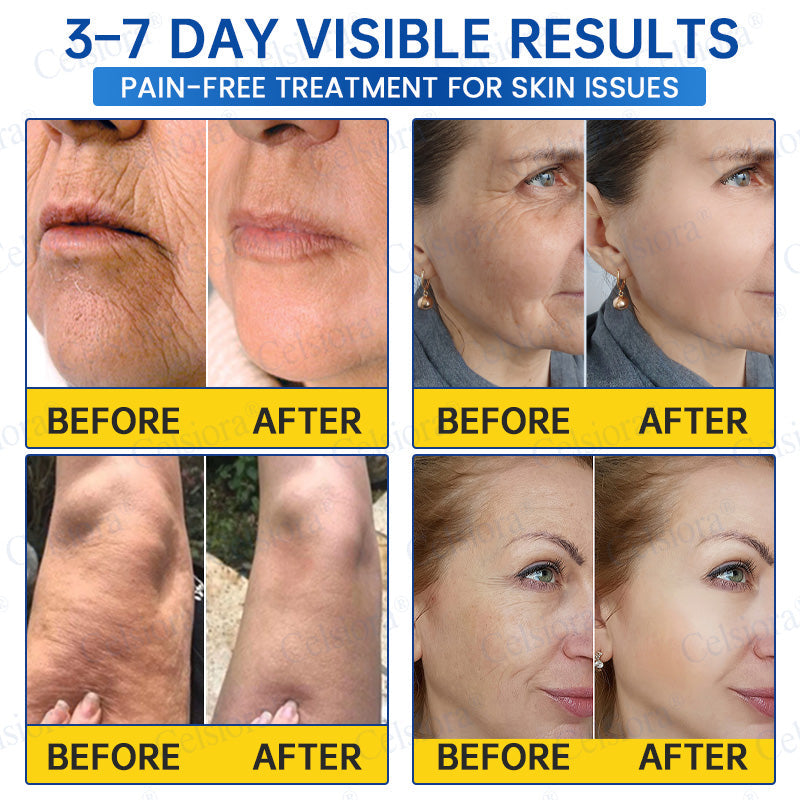 🌐🍃Celsiora® Botox & PDRN Anti-Wrinkle Shot – Lift & Firming Cream
