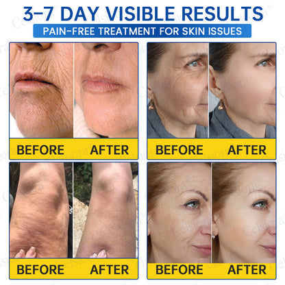 🌐🍃Celsiora® Botox & PDRN Anti-Wrinkle Shot – Lift & Firming Cream