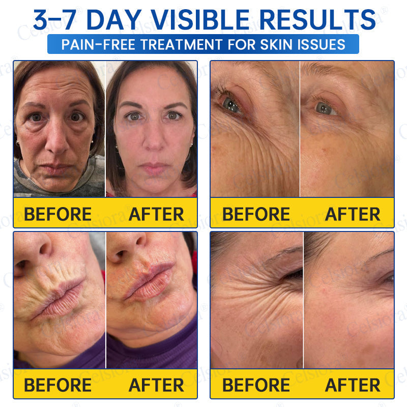 🌐🍃Celsiora® Botox & PDRN Anti-Wrinkle Shot – Lift & Firming Cream