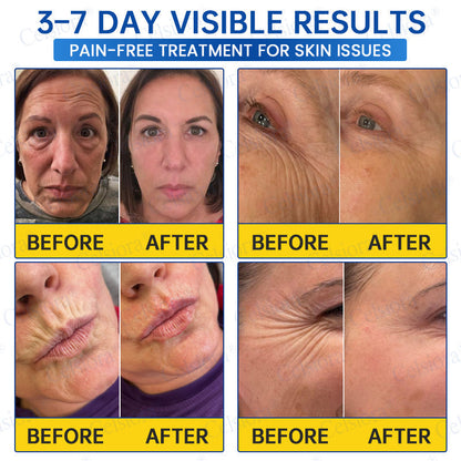 🌐🍃Celsiora® Botox & PDRN Anti-Wrinkle Shot – Lift & Firming Cream