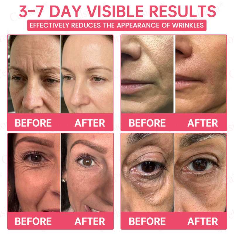 🩷💫Celsiora® PDRN Pink Peptide Eye Cream