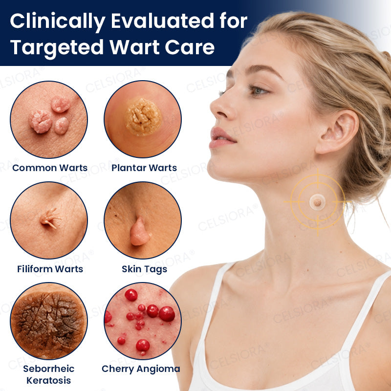🧶GFOUK® 7-Day MicroNeedle Wart & Skin Tag Removal Patch