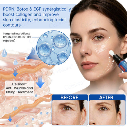 🌐🍃Celsiora® Botox & PDRN Anti-Wrinkle Shot – Lift & Firming Cream